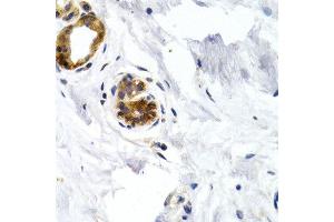 Immunohistochemistry of paraffin-embedded human normal breast using GDF5 antibody at dilution of 1:200 (400x lens). (GDF5 Antikörper)