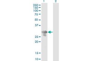 Western Blot analysis of PCGF5 expression in transfected 293T cell line by PCGF5 monoclonal antibody (M01), clone 3C10. (PCGF5 Antikörper  (AA 51-148))