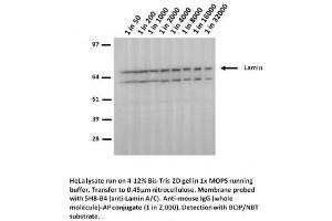 Image no. 1 for anti-Lamin A/C (LMNA) (Arg482Trp-Mutant) antibody (ABIN1042617) (Lamin A/C Antikörper  (Arg482Trp-Mutant))