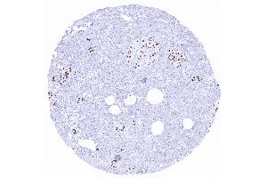 Moderate to strong INSM1 immunostaining in most cells of Langerhans islets of the pancreas (Rekombinanter INSM1 Antikörper  (AA 81-125))