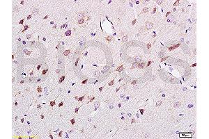 Formalin-fixed and paraffin embedded rat brain tissue labeled Anti-NF-H/Neurofilament H/Neurofilament 200 Polyclonal Antibody (ABIN672156), Unconjugated at 1:200, followed by conjugation to the secondary antibody and DAB staining (NEFH Antikörper  (AA 1-100))