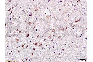 Formalin-fixed and paraffin embedded rat brain tissue labeled Anti-NF-H/Neurofilament H/Neurofilament 200 Polyclonal Antibody (ABIN672156), Unconjugated at 1:200, followed by conjugation to the secondary antibody and DAB staining