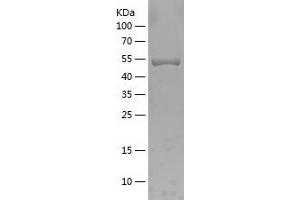 Western Blotting (WB) image for Cyclin D1 (CCND1) (AA 11-285) protein (His-IF2DI Tag) (ABIN7122523) (Cyclin D1 Protein (CCND1) (AA 11-285) (His-IF2DI Tag))