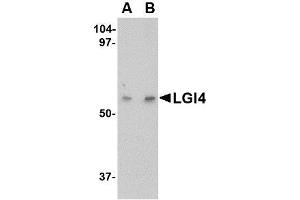 Western blot analysis of LGI4 in human brain tissue lysate with LGI4 antibody at (A) 1 and (B) 2 µg/ml.