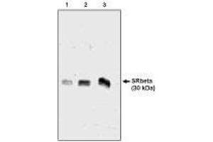 Western blot analysis  using SRβ antibody  ng  of canine microsomal protein  Chicken, Dog (SRPRB Antikörper  (AA 246-265))