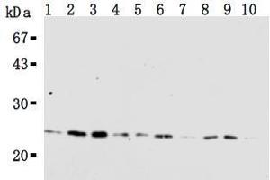 Western Blotting (WB) image for anti-RAN, Member RAS Oncogene Family (RAN) antibody (ABIN1449197) (RAN Antikörper)