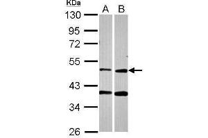 WB Image Sample (30 ug of whole cell lysate) A: A549 B: HCT116 10% SDS PAGE antibody diluted at 1:2000 (PPOX Antikörper)