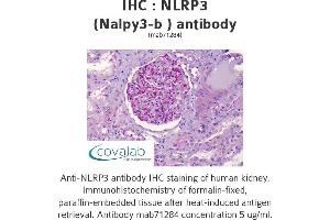 Image no. 1 for anti-NLR Family, Pyrin Domain Containing 3 (NLRP3) antibody (ABIN1724101) (NLRP3 Antikörper)