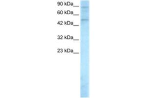 Western Blotting (WB) image for anti-SMAD, Mothers Against DPP Homolog 5 (SMAD5) antibody (ABIN2460351)