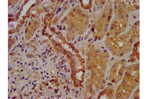 IHC image of ABIN7170211 diluted at 1:400 and staining in paraffin-embedded human kidney tissue performed on a Leica BondTM system. (SLC26A6 Antikörper  (AA 554-668))