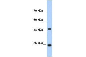 WB Suggested Anti-FBP1 Antibody  Titration: 1. (FBP1 Antikörper  (N-Term))