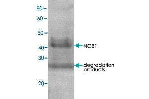 Detection of RPN7 (51. (NOB1 Antikörper)