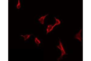 ABIN6275784 staining HeLa by IF/ICC. (PLA2G6 Antikörper  (Internal Region))