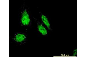 Immunofluorescence of monoclonal antibody to RHOXF1 on HeLa cell.