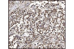 IHC analysis of FABP-1/GOT2 using anti-FABP-1/GOT2 antibody (ABIN7601426). (GOT2 Antikörper  (AA 35-430))