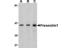 Western Blotting (WB) image for anti-Presenilin 1 (PSEN1) (C-Term) antibody (ABIN1030600) (Presenilin 1 Antikörper  (C-Term))