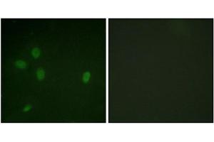Immunofluorescence analysis of NIH/3T3 cells, using 53BP1 (Phospho-Ser25) antibody. (TP53BP1 Antikörper  (pSer25))