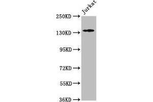 Western Blot Positive WB detected in: Jurkat whole cell lysate All lanes: ATP2B3 antibody at 1:500 Secondary Goat polyclonal to rabbit IgG at 1/50000 dilution Predicted band size: 135, 129, 128, 133, 127, 125, 123 kDa Observed band size: 135 kDa (ATP2B3 Antikörper  (AA 1057-1220))