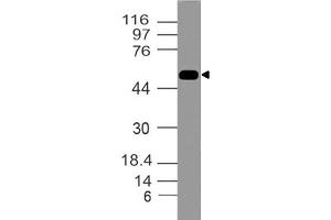 Image no. 1 for anti-Tumor Necrosis Factor Receptor Superfamily, Member 10a (TNFRSF10A) (AA 2-203) antibody (ABIN5027281) (TNFRSF10A Antikörper  (AA 2-203))