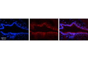 Immunohistochemistry (IHC) image for anti-Forkhead Box K2 (FOXK2) (Middle Region) antibody (ABIN2776014)