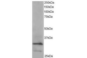 Image no. 1 for anti-Actin Related Protein 2/3 Complex, Subunit 2, 34kDa (ARPC2) (C-Term) antibody (ABIN374215) (ARPC2 Antikörper  (C-Term))