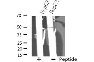 Western blot analysis of extracts from HepG2 cells using ADCK3 antibody.