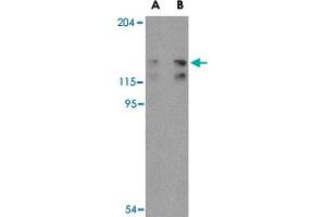 Western blot analysis of FYB in K-562 cell lysate with FYB polyclonal antibody  at (A) 0. (FYB Antikörper  (C-Term))