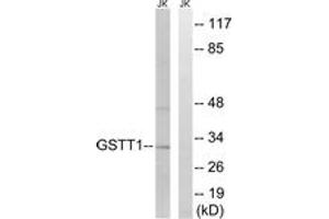 Western blot analysis of extracts from Jurkat cells, using GSTT1/4 Antibody.