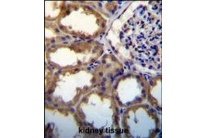 PDGFC antibody immunohistochemistry analysis in formalin fixed and paraffin embedded human kidney tissue followed by peroxidase conjugation of the secondary antibody and DAB staining. (PDGFC Antikörper  (N-Term))