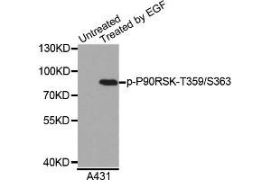 Western blot analysis of extracts of A431 cells, using Phospho-P90RSK-T359/S363 antibody. (RPS6KA3 Antikörper)