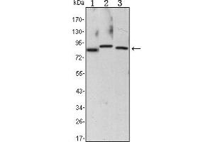 Western blot analysis using CHUK mouse mAb against Raji (1), Jurkat (2) and THP-1 (3) cell lysate. (IKK alpha Antikörper)
