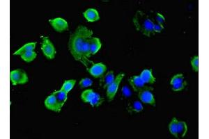 Immunofluorescent analysis of MCF-7 cells using ABIN7177361 at dilution of 1:100 and Alexa Fluor 488-congugated AffiniPure Goat Anti-Rabbit IgG(H+L) (IDH1 Antikörper  (AA 1-240))