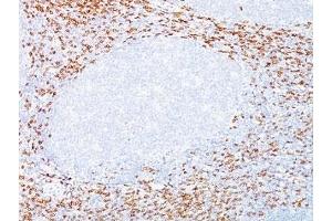 Formalin-fixed, paraffin-embedded human tonsil stained with CD8a antibody (C8/468 + C8/144B).