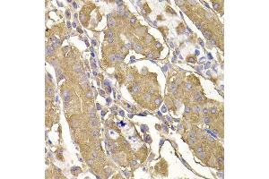 Immunohistochemistry of paraffin-embedded human stomach using RASGRF1 antibody at dilution of 1:100 (x400 lens). (RASGRF1 Antikörper)