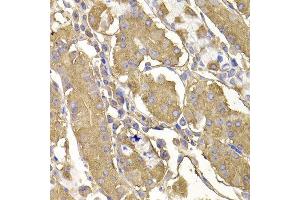 Immunohistochemistry of paraffin-embedded human stomach using RASGRF1 antibody at dilution of 1:100 (x400 lens).