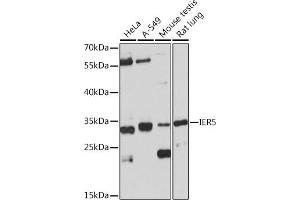 Western blot analysis of extracts of various cell lines, using IER5 Rabbit pAb (ABIN7267843) at 1:1000 dilution. (IER5 Antikörper)