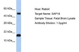 Host: Rabbit Target Name: SAP18 Sample Tissue: Human Fetal Brain Antibody Dilution: 1ug/ml (SAP18 Antikörper  (N-Term))