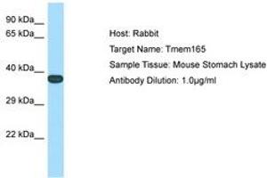 Image no. 1 for anti-Transmembrane Protein 165 (TMEM165) (N-Term) antibody (ABIN6749912)