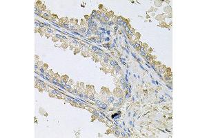 Immunohistochemistry of paraffin-embedded human prostate using PPIC antibody at dilution of 1:100 (x40 lens). (PPIC Antikörper)