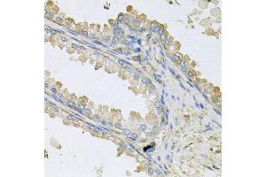 Immunohistochemistry of paraffin-embedded human prostate using PPIC antibody at dilution of 1:100 (x40 lens).