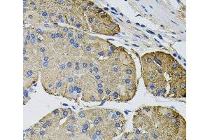 Immunohistochemistry of paraffin-embedded Human stomach using THBS2 Polyclonal Antibody at dilution of 1:100 (40x lens). (Thrombospondin 2 Antikörper)