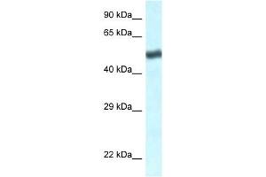 Western Blot showing TBL1XR1 antibody used at a concentration of 1 ug/ml against Jurkat Cell Lysate (TBL1XR1 Antikörper  (C-Term))