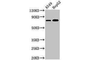 Western Blot Positive WB detected in: A549 whole cell lysate, HepG2 whole cell lysate All lanes: TBC1D15 antibody at 3 μg/mL Secondary Goat polyclonal to rabbit IgG at 1/50000 dilution Predicted band size: 80, 78, 79 kDa Observed band size: 80 kDa (TBC1D15 Antikörper  (AA 283-404))