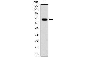 Western blot analysis using G6PD mAb against human G6PD (AA: 275-515) recombinant protein. (Glucose-6-Phosphate Dehydrogenase Antikörper)