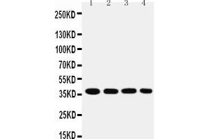 Anti-MTCO1 antibody, Western blotting Lane 1: SMMC Cell Lysate Lane 2: MCF-7 Cell Lysate Lane 3: RAJI Cell Lysate Lane 4: SW620 Cell Lysate (COX1 Antikörper  (C-Term))