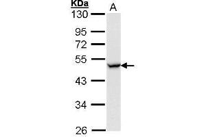 WB Image Sample (30 ug of whole cell lysate) A: Hela 10% SDS PAGE antibody diluted at 1:1000 (CCR8 Antikörper  (Center))