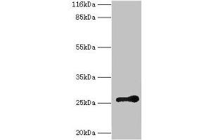 Western blot All lanes: RAB3C antibody at 2 μg/mL + Mouse brain tissue Secondary Goat polyclonal to rabbit IgG at 1/10000 dilution Predicted band size: 26 kDa Observed band size: 26 kDa (Rab3c Antikörper  (AA 1-227))