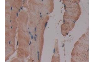 Detection of GLUD1 in Mouse Skeletal muscle Tissue using Polyclonal Antibody to Glutamate Dehydrogenase 1 (GLUD1) (GLUD1 Antikörper  (AA 65-273))