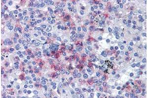 Human Spleen: Formalin-Fixed, Paraffin-Embedded (FFPE) (SPI1 Antikörper  (AA 1-122))