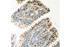 IHC analysis of GLB1 using anti-GLB1 antibody (ABIN7599649).